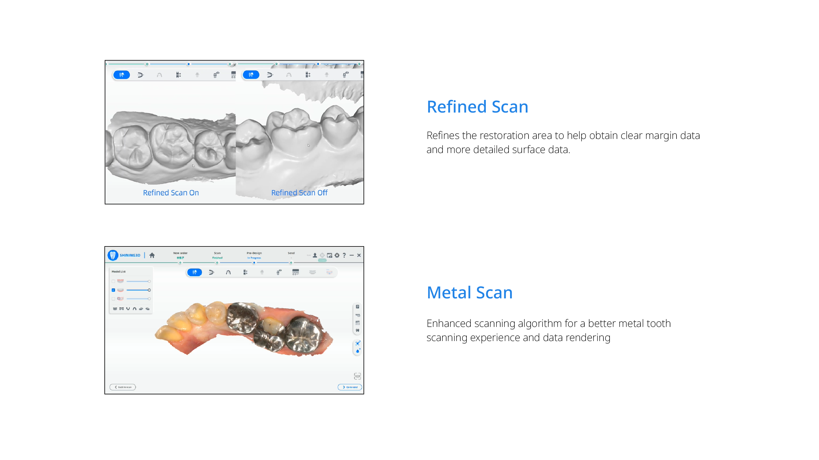 Aoralscan 3 wireless