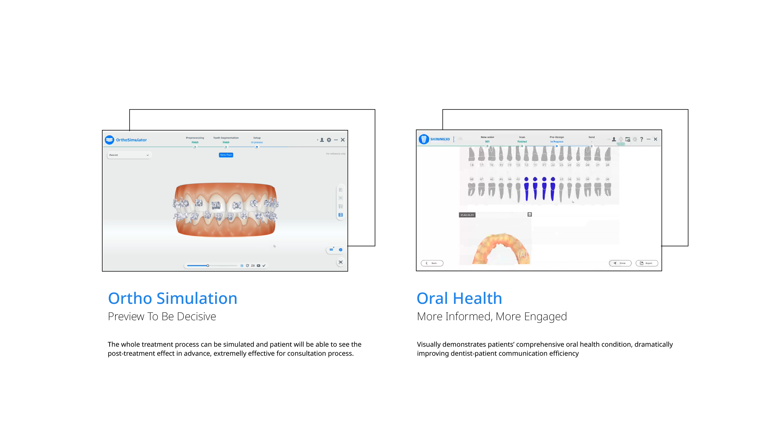 Aoralscan 3 wireless