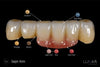 Lunar Universal Stain & Glaze & Gum Kit