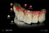 Lunar Universal Stain & Glaze & Gum Kit