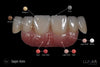Lunar Universal Stain & Glaze & Gum Kit