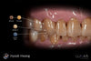 Lunar Universal Stain & Glaze & Gum Kit