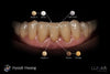 Lunar Universal Stain & Glaze & Gum Kit