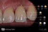 Lunar Universal Stain & Glaze & Gum Kit