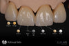 Lunar Universal Stain & Glaze & Gum Kit