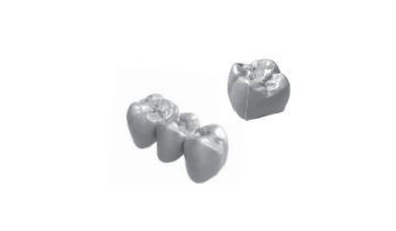 Crown and coping