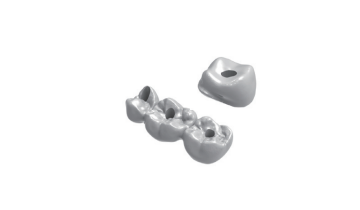 Screw-retained bridge