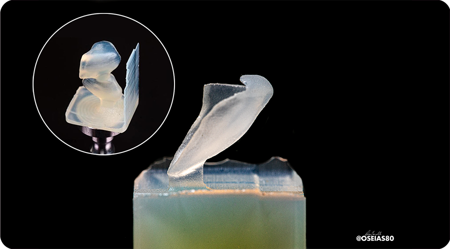 Amber Mill veneer clinical case