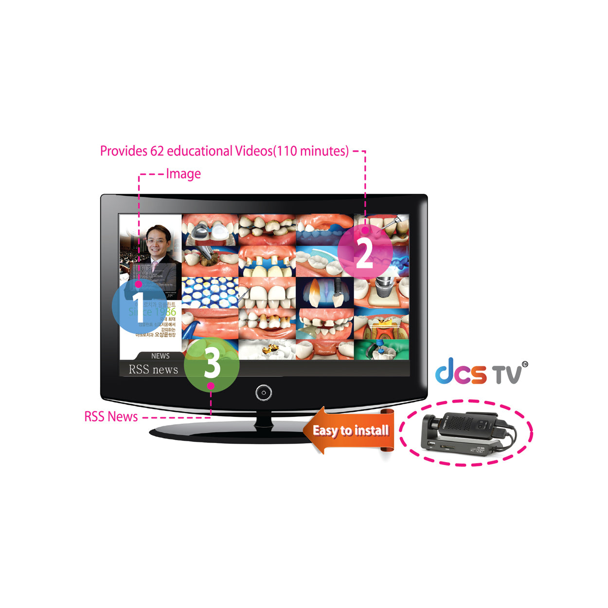 DCS TV, dental tv, dentist tv, dental marketing tv, dental educational tv